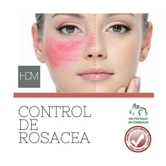 HDM Crema para Rubor cutaneo Descongestiva Anti rojeces Rosacea - comprar online