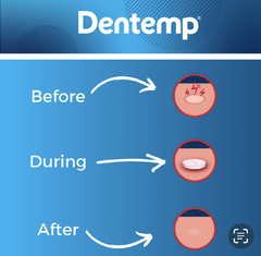 Dentemp Canker Cover P/ Tratamento De Aftas Com 6 Tabletes - Mimos de Orlando