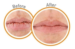 Protetor Labial O Keeffes Lip Repair Sem Cheiro Kit Com 2 - comprar online