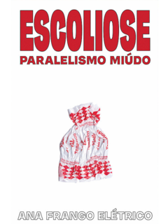 Escoliose: paralelismo míudo