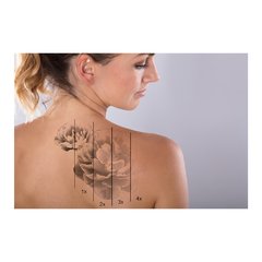 Painel Adesivo de Parede - Remoção de Tatuagem - 1199pn - comprar online