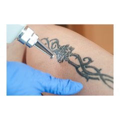 Painel Adesivo de Parede - Remoção de Tatuagem - 1200pn - comprar online