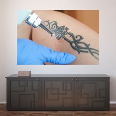 Painel Adesivo de Parede - Remoção de Tatuagem - 1200pn