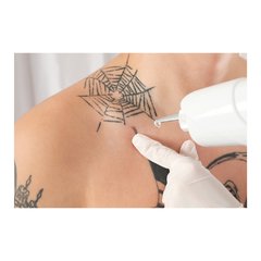 Painel Adesivo de Parede - Remoção de Tatuagem - 1202pn - comprar online