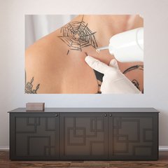 Painel Adesivo de Parede - Remoção de Tatuagem - 1202pn