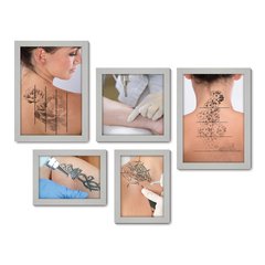 Kit Com 5 Quadros Decorativos - Remoção Tatuagem Tattoo - 131kq01 - Allodi