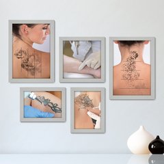 Kit Com 5 Quadros Decorativos - Remoção Tatuagem Tattoo - 131kq01 - comprar online