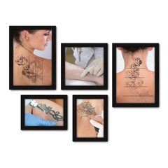Kit Com 5 Quadros Decorativos - Remoção Tatuagem Tattoo - 131kq01 na internet