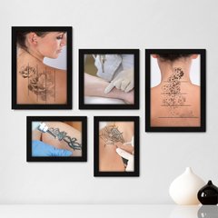 Kit Com 5 Quadros Decorativos - Remoção Tatuagem Tattoo - 131kq01