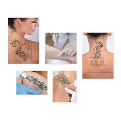 Kit 5 Placas Decorativas - Remoção Tatuagem Tattoo Casa Quarto Sala - 131ktpl5 - comprar online