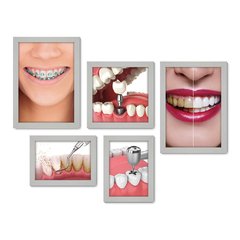 Kit Com 5 Quadros Decorativos - Dentista Consultório - 185kq01 - Allodi