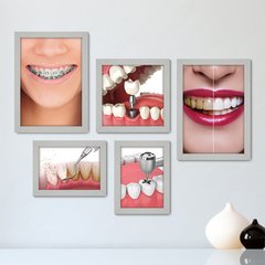 Kit Com 5 Quadros Decorativos - Dentista Consultório - 185kq01 - comprar online