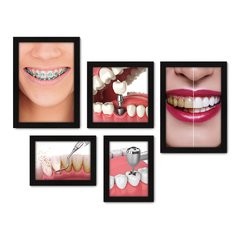 Kit Com 5 Quadros Decorativos - Dentista Consultório - 185kq01 na internet