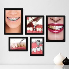 Kit Com 5 Quadros Decorativos - Dentista Consultório - 185kq01