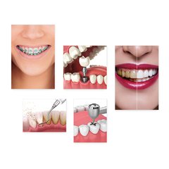 Kit 5 Placas Decorativas - Dentista Consultório Casa Quarto Sala - 185ktpl5 - comprar online