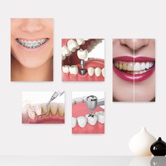 Kit 5 Placas Decorativas - Dentista Consultório Casa Quarto Sala - 185ktpl5