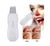 Espátula Facial Ultrasónica Peeling Skin Scrubber Recargable