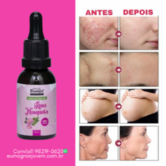 Oleo De Rosa Mosqueta Natural 100% Puro Clareamento Facial- 30ml - comprar online