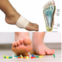Plantilla Fascitis Media Plantar Ortopédica Tv Agnovedades - tienda online