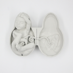 Vida I Bebê e Placenta I Escultura - GRIFTA