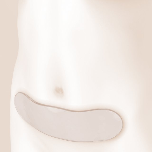 Lámina de gel post cirugía abdominal - comprar online