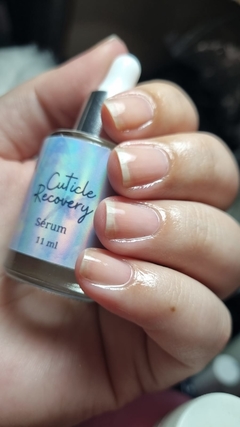 Imagem do Cuticle Recovery