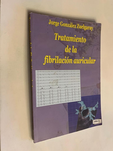 Tratamiento de la fibrilación auricular - Jorge González Zuelgaray