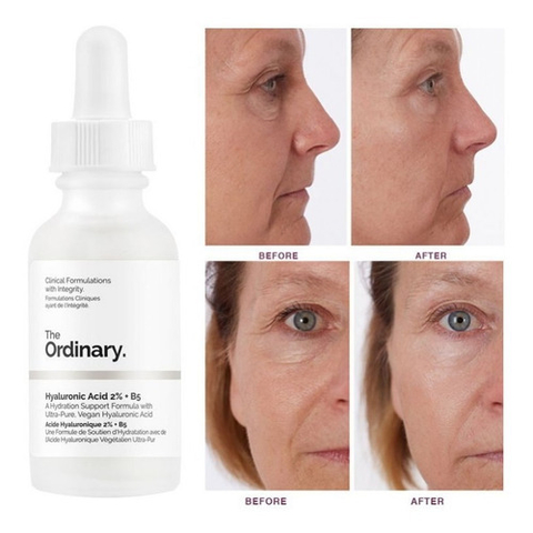 The Ordinary Serum Niacinamide 10% + Zinc 1 % x 30ML en internet