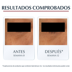 Eucerin Anti-Pigment Contorno de Ojos Anti-Ojeras 15ml - tienda online