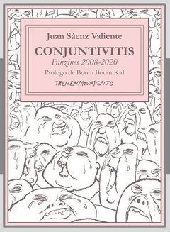 Conjuntivitis, Juan Saenz Valiente