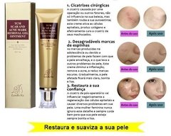 Creme de Remoção de Cicatrizes cod 973 - Divino Charme