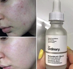 The Ordinary - Niacinamide 10% + Zinc 1% 30ml - comprar online