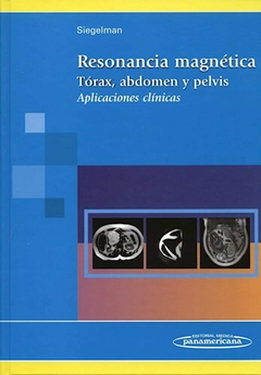 Resonancia magnetica Torax, abdomen y pelvis - Siegelman - Editorial Medica Panamericana