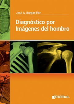 Diagnostico por Imagenes del hombro - Burgos Flor - Ediciones Journal