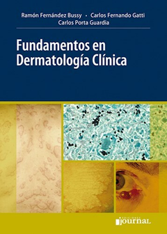 Fundamentos en dermatologia clinica - Fernandez Bussy - Ediciones Journal