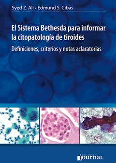 El Sistena Bethesda para informar la citopatologia de tiroides - Ali/Cibas - Ediciones Journal