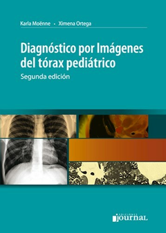 Diagnostico por imagenes del torax pediatrico - Moenne/Ortega - Ediciones Journal