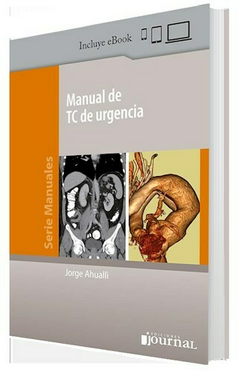 Manual de TC de urgencia - Jorge Ahualli - Editorial Journal