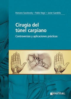 Cirugia del tunel carpiano - Socolovsky/Negri/Gardella - Ediciones Journal