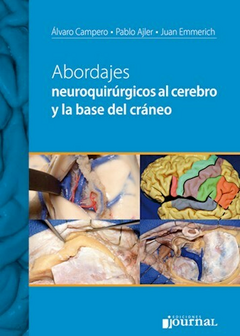 Abordajes neuroquirúrgicos al cerebro y la base del cráneo- Álvaro Campero Pablo Ajler Juan Emmerich - Ediciones Joutnal Sociedad Anonima