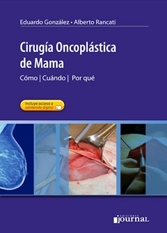 Cirugia Ocoplastica de Mama - Gonzalez/Rancati - Ediciones Journal