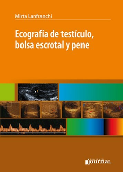 Ecografia de testiculo, bolsa escrotal y pene - Mirta Lanfranchi - Ediciones Journal