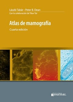 Atlas de mamografia - Tabar/B Dean - Ediciones Journal