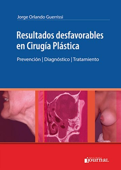 Resultados desfavorables en Cirugia Plastica - Orlando Guerrissi - Ediciones Journal