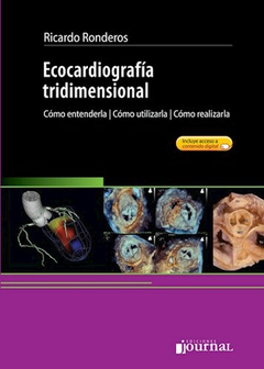 Ecocardiografia tridimensional - Ricardo Ronderos - Ediciones Journal