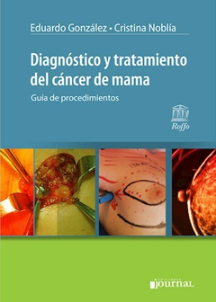 Diagnostico y tratamiento del cancer de mama - Gonzalez/Noblia - Ediciones Journal