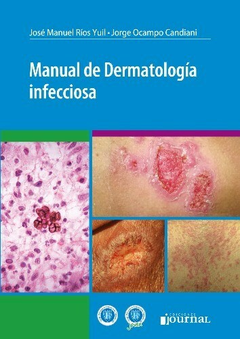 Manual de dermatologia infecciosa - Juan Manuel Rios Yuil - Ediciones Journal