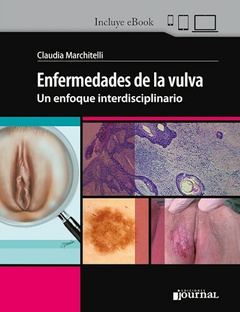 Enfermedades de la vulva - Marchitelli - Ediciones Journal