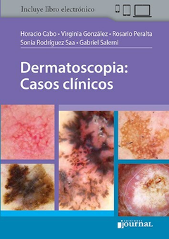 Dermatoscopia Casos clinicos - Horacio Cabo - Ediciones Journal