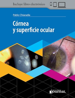 Cornea y superficie ocular - Pablo Chiaradia - Ediciones Journal